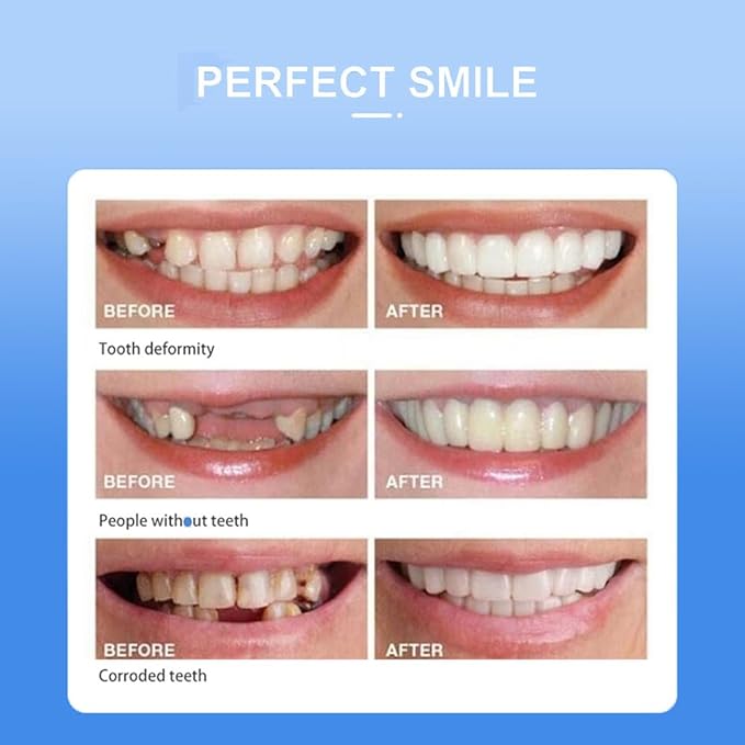 Snap in Teeth for Men and Women